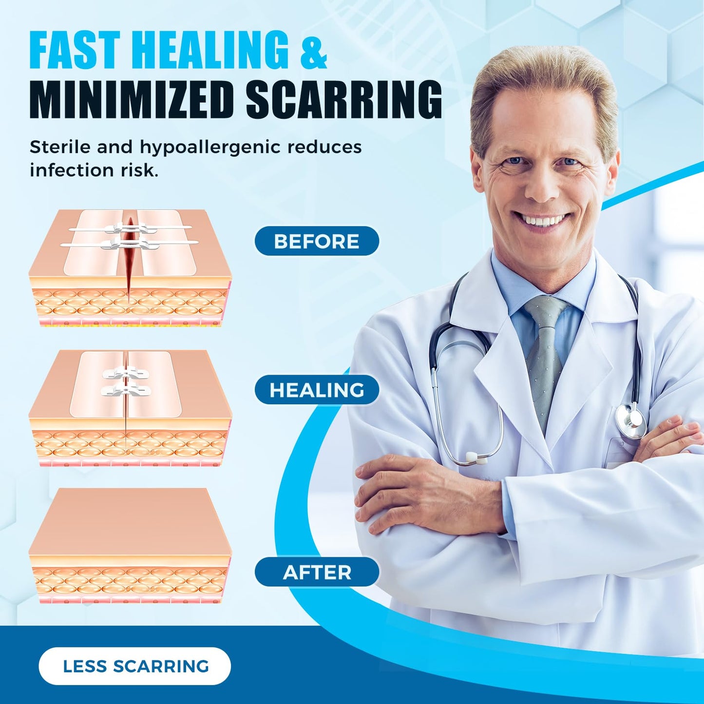 Large butterfly bandage suitable for very large wounds